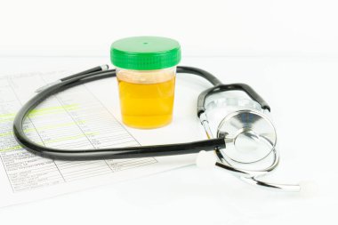 Rutin idrar tahlili, kontrol stetoskop