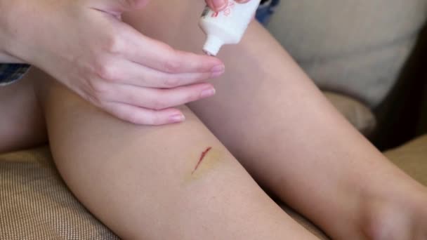 Young Girl Smears Wound Bruise His Leg Healing Cream — Stock Video