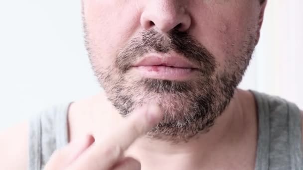 大人の中年ひげを生やした男の閉鎖は 保湿クリーム ヘルペス治療で唇を潤滑します 健康なスキンケア 男性の美しさの概念 — ストック動画