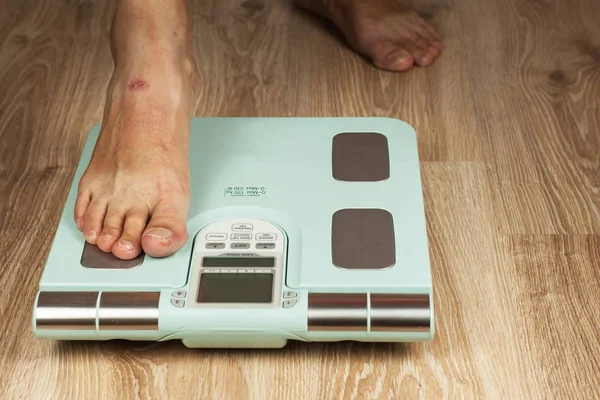 Ο παλιός άνθρωπος στέκεται σε μια σύγχρονη κλίμακα. Μέτρηση περιεκτικότητας λίπους του σώματος. Ευφυής ιατρική βάρος. Η έννοια της παχυσαρκίας. — Φωτογραφία Αρχείου