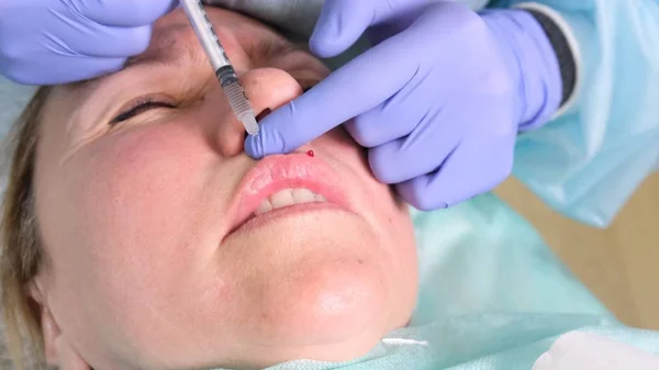 O cosmetologist executa um procedimento para aumentar os lábios de uma mulher em um salão de beleza. cuidados com a pele. Injeções cosméticas . — Fotografia de Stock