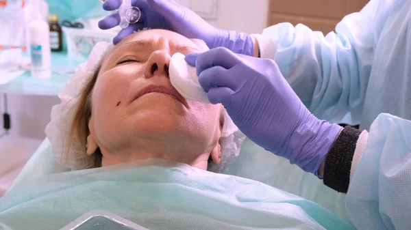 Powiększenie ust. Lekarz kosmetyk robi zabieg kosmetyczny kobiecym wargom za pomocą strzykawki. Starsza kobieta. Powiększenie warg. — Zdjęcie stockowe
