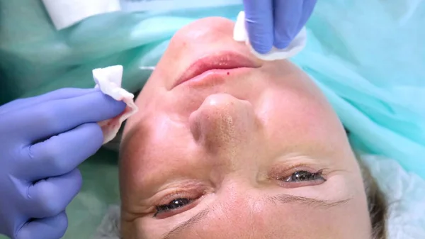 Il dottore cosmetologo prepara una faccia di donne a un'iniezione cosmetica, iniezioni di acido ialuronico. Una donna in un salone di bellezza. clinica di chirurgia plastica — Foto Stock