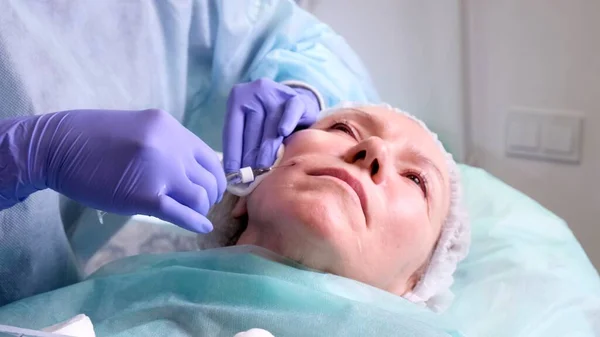 Middle aged woman 50 getting a lifting injection of an injection of hyaluronic acid into the face by a doctor cosmetologist. Cosmetic procedure. close-up