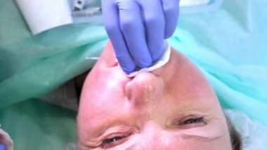 Kozmetik doktoru bir kadının yüzünü kozmetik enjeksiyon için hazırlıyor. Hyaluronik asit enjekte ediliyor. Güzellik salonunda bir kadın. Plastik cerrahi kliniği