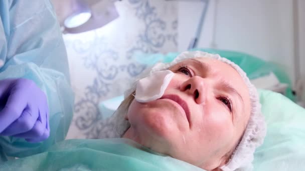 Жінка середнього віку 50 отримує ліфтинг ін'єкції гіалуронової кислоти в обличчя лікарем-косметологом. Косметична процедура. крупним планом — стокове відео