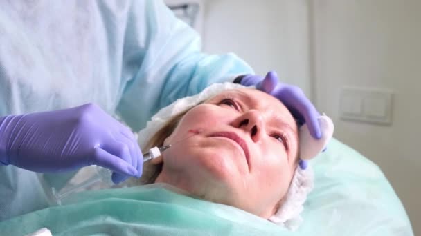 Женщина средних лет 50 лет получает подъемную инъекцию гиалуроновой кислоты в лицо от врача-косметолога. Косметическая процедура. макро — стоковое видео