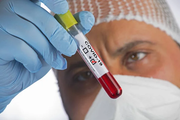 Kan Örneğinde Covid Veya Coronavirus Bulundu Stok Fotoğraf