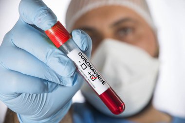 Kan örneğinde Covid-19 veya Coronavirus etiketi pozitif.