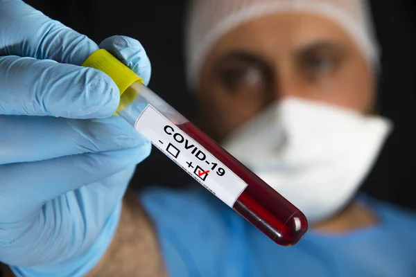 Kan Örneğinde Covid Veya Coronavirus Etiketi Pozitif Telifsiz Stok Imajlar