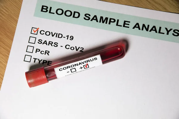 Coronavirus Üzerinde Kan Olan Test Tüpü Covid19 Test Sonuçları Yukarıdan - Stok İmaj