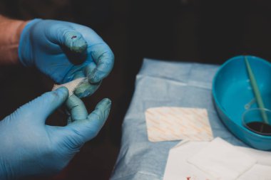 Bir cerrah ya da ayak hastalıkları uzmanı ayağından küçük bir ameliyat yapıyor.. 