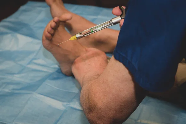 Ayak bileğine lokal anestezi yapan bir pediatrist ayağına cerrahi müdahale yapmadan önce.... 