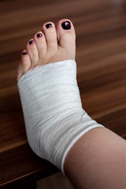 Dişi, ayak yaralanmasını bandajla sarıyor.