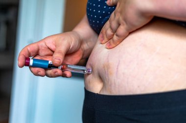 Şişman kadın karnına diyabet ilacı enjekte ediyor.