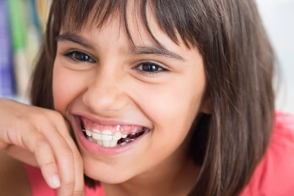 Красивая улыбка с ортодонтическим прибором — стоковое фото