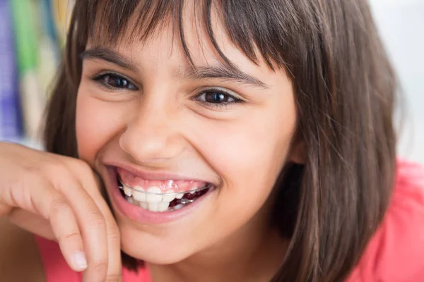 Beautiful smile with orthodontic appliance — Stock Photo, Image