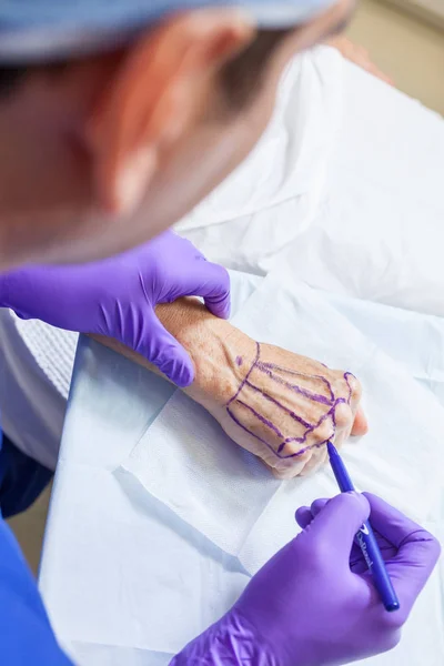 Plastischer Chirurg markiert Hand von Seniorin für Operation — Stockfoto