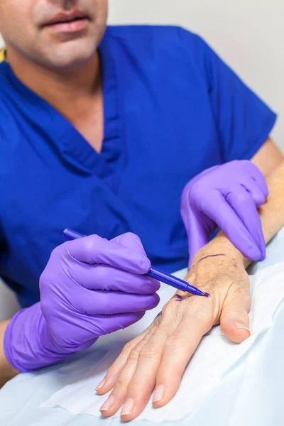 Médico de Cirurgião Plástico Marcando Mão de Mulher Sênior Para Cirurgia — Fotografia de Stock