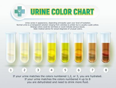 Urine Color Chart 1 clipart