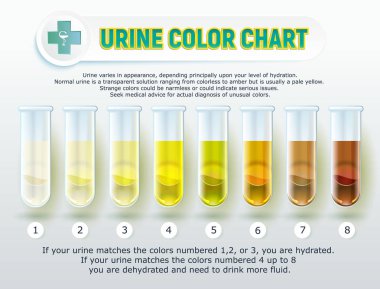 Urine Color Chart 1 clipart