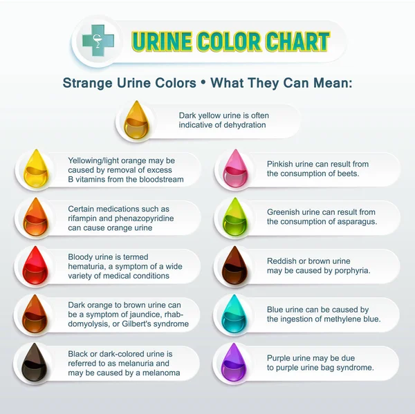 Urine Kleurenoverzicht 2 — Stockvector