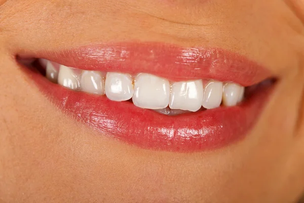The perfect smile — Stock Photo, Image