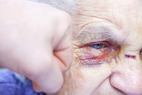 冲一名受伤的老年妇女 — 图库照片