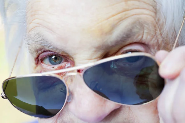 Injured elderly woman's face — Stock Photo, Image