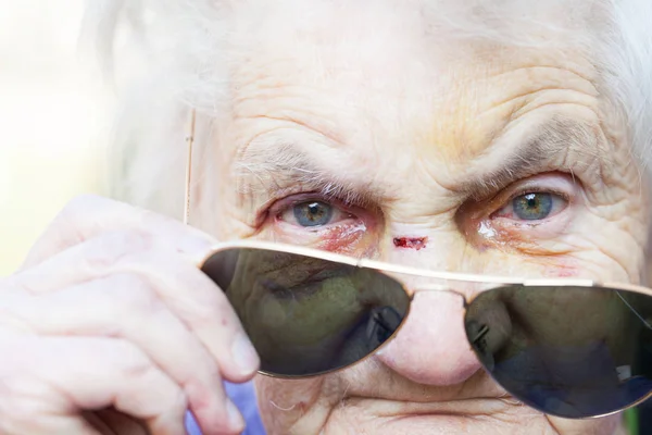 Injured elderly woman's face — Stock Photo, Image