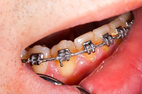L'esame ortodontico — Foto Stock