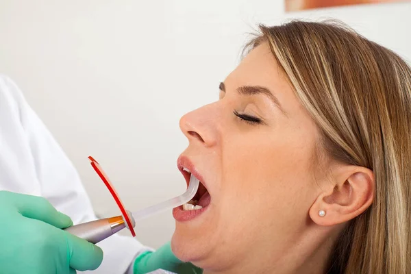 Polimerizzazione dentale con lampada uv — Foto Stock