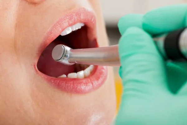 Dental treatment close up — Stock Photo, Image