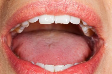 Kadın oral kavite portre