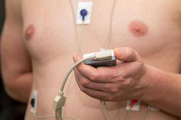 Видеорегистратор Холтера
