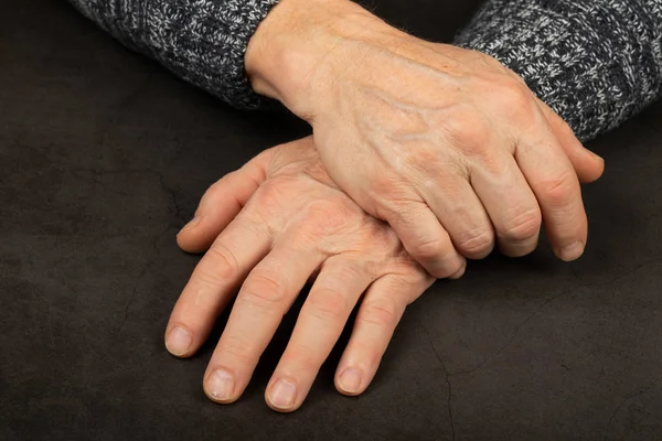 Nahaufnahme Einer Faltigen Älteren Hand — Stockfoto