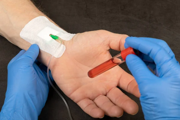 Orvosi Dolgozó Kezében Kémcső Vérplazmával — Stock Fotó