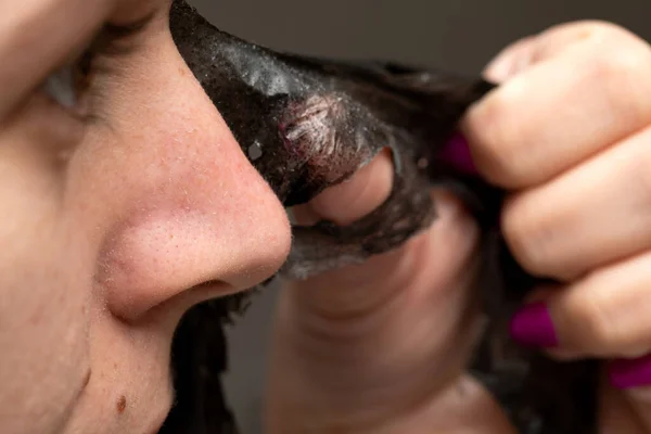 Close Foto Van Vrouw Verwijderen Van Zwarte Houtskool Schil Gezichtsmasker — Stockfoto