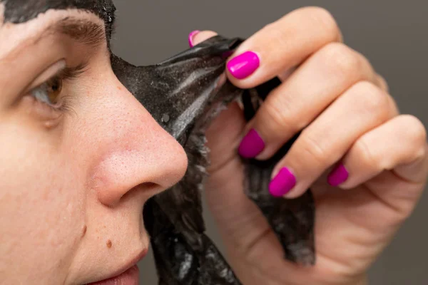 Nahaufnahme Einer Frau Die Schwarze Holzkohleschalen Von Der Gesichtsmaske Entfernt — Stockfoto