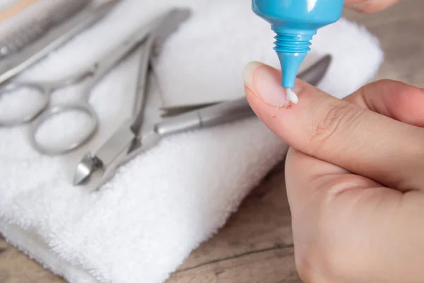 Kremi tırnak etindeki yaraya sür. Manikürden sonraki yara. Bir çizik, bir kesik. Manikür, tırnak bakımı. Manikür salonu, prosedür, spa. Evde tırnak bakımı. Manikür aletleri. Güzellik, yaşam tarzı