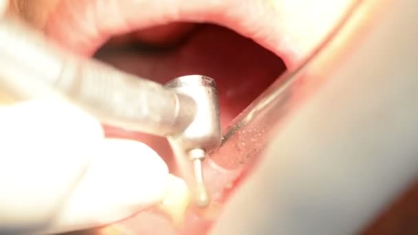 Makro Snímek Zubu Vrtací Stroj Provozu — Stock video