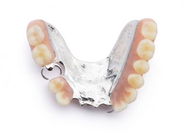 Kısmi takma diş üst tarafı. Beyaz arka plan üzerinde izole.