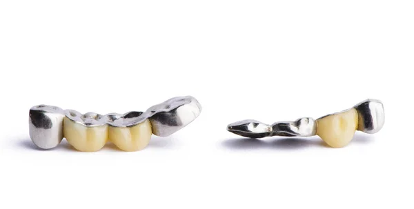 Ceramic Dentures Isolated White Background — Stock Photo, Image