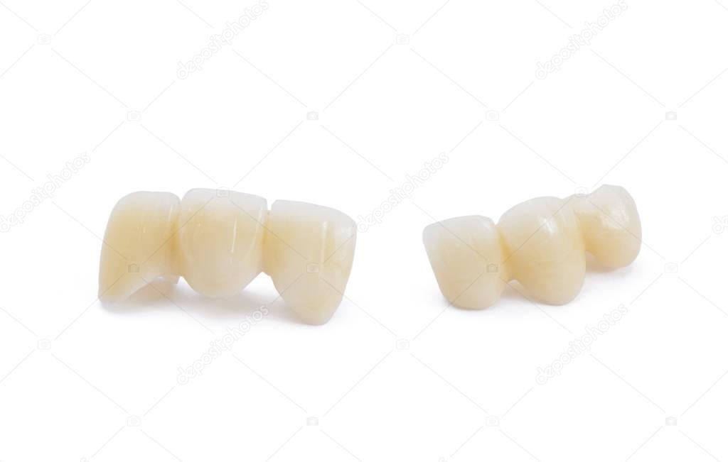 Ceramic dentures on white background