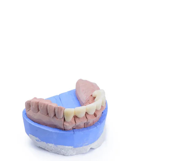 Modello Dentale Attrezzatura Dentale Sfondo Bianco Con Spazio Copia — Foto Stock
