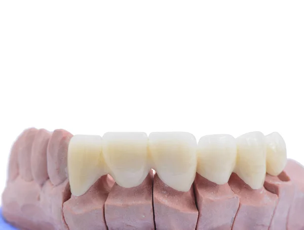 Закрыть Стоматологическую Модель Белом Фоне — стоковое фото
