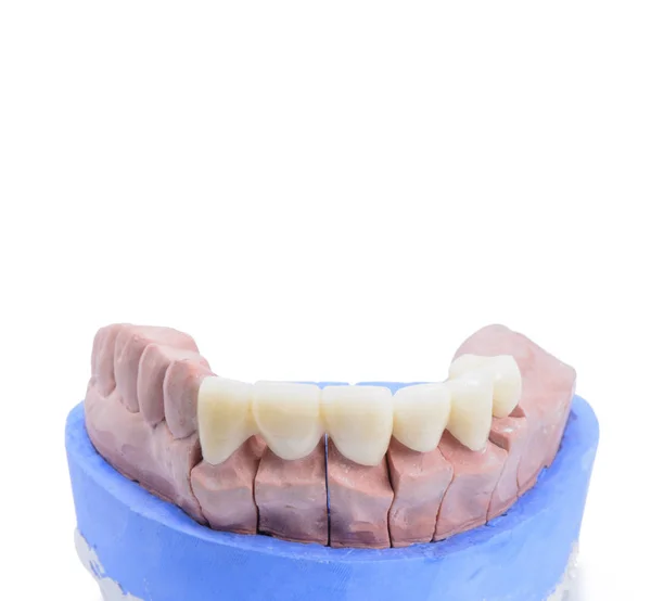 Primer Modelo Dental Sobre Fondo Blanco Con Espacio Para Copiar — Foto de Stock