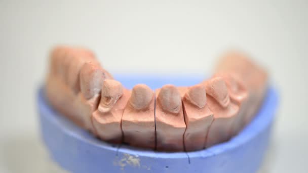 Técnico Odontológico Trabalhando Molde Impresso Para Implantes Dentários — Vídeo de Stock