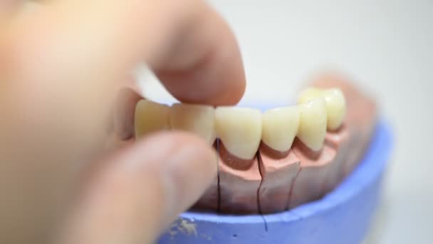 Odontotecnico Che Lavora Stampi Stampati Impianti Dentali Laboratorio — Video Stock