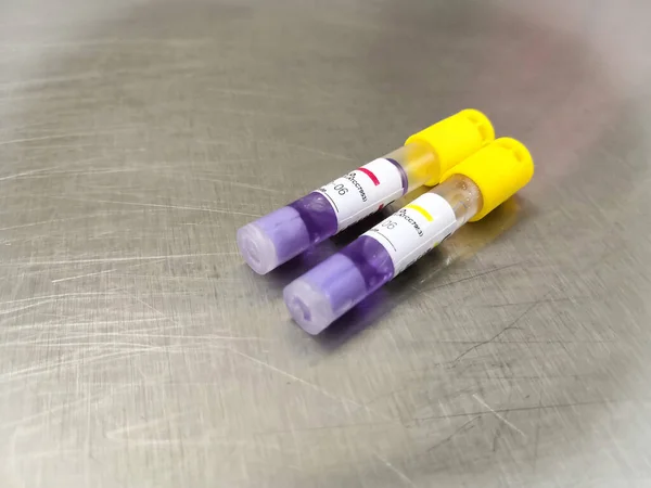 Düşük Sıcaklık Sterilizasyon Biyolojik Göstergesi